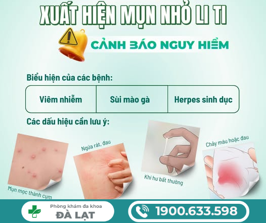 Hình ảnh minh họa